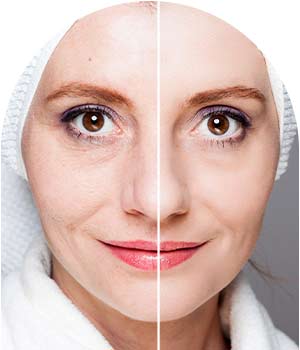 Before and After Images for Flawless Palm Beach Med Spa in West Palm Beach, FL, Royal Palm Beach, FL, and Lantana, FL