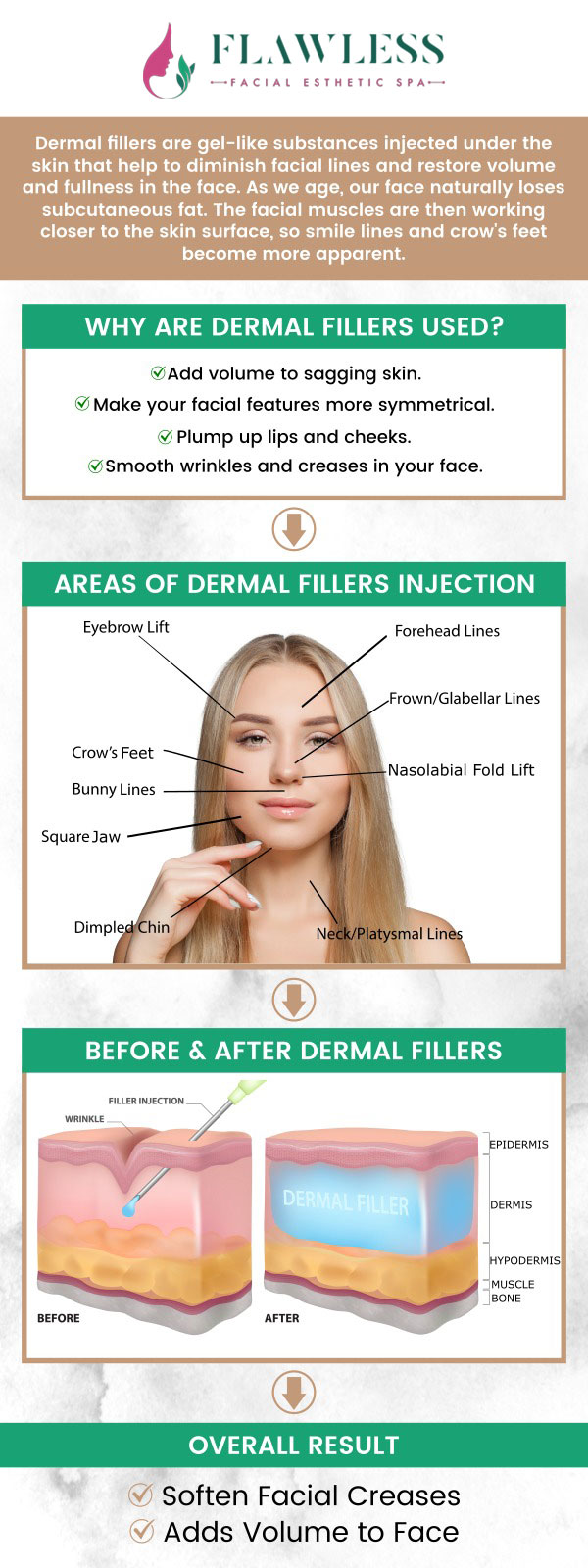 Dermal fillers represent a sophisticated solution for addressing the visible signs of aging by restoring lost volume and smoothing out facial contours. Unlike treatments that simply relax muscles, fillers utilize injectable gels to physically plump the skin from within, targeting everything from deep-set wrinkles and fine lines to hollowed cheeks and thin lips. Consult Dr. Aditi Patel at Flawless Palm Beach Med Spa. For more information, contact us or request an appointment online. We have convenient locations to serve you in West Palm Beach, Lantana, and Royal Palm Beach, FL. Dermal fillers represent a sophisticated solution for addressing the visible signs of aging by restoring lost volume and smoothing out facial contours. Unlike treatments that simply relax muscles, fillers utilize injectable gels to physically plump the skin from within, targeting everything from deep-set wrinkles and fine lines to hollowed cheeks and thin lips. Consult Dr. Aditi Patel at Flawless Palm Beach Med Spa. For more information, contact us or request an appointment online. We have convenient locations to serve you in West Palm Beach, Lantana, and Royal Palm Beach, FL.