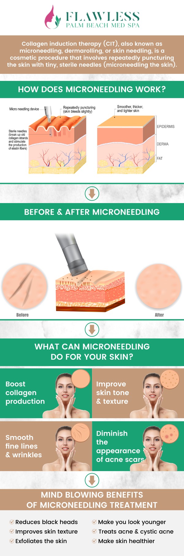 RF microneedling combines traditional microneedling with radiofrequency energy, stimulating the production of collagen and elastin for firmer, smoother skin. This dual-action treatment effectively addresses a range of concerns, including fine lines, wrinkles, acne scars, and uneven texture. At Flawless Palm Beach Med Spa, Dr. Aditi Patel provides essential pre- and post-care instructions, ensuring optimal results and a smooth recovery with minimal downtime. For more information, contact us or request an appointment online. We have convenient locations to serve you in West Palm Beach, Lantana, and Royal Palm Beach, FL. RF microneedling combines traditional microneedling with radiofrequency energy, stimulating the production of collagen and elastin for firmer, smoother skin. This dual-action treatment effectively addresses a range of concerns, including fine lines, wrinkles, acne scars, and uneven texture. At Flawless Palm Beach Med Spa, Dr. Aditi Patel provides essential pre- and post-care instructions, ensuring optimal results and a smooth recovery with minimal downtime. For more information, contact us or request an appointment online. We have convenient locations to serve you in West Palm Beach, Lantana, and Royal Palm Beach, FL.