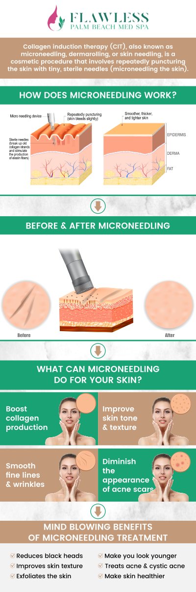 RF microneedling combines traditional microneedling with radiofrequency energy, stimulating the production of collagen and elastin for firmer, smoother skin. This dual-action treatment effectively addresses a range of concerns, including fine lines, wrinkles, acne scars, and uneven texture. At Flawless Palm Beach Med Spa, Dr. Aditi Patel provides essential pre- and post-care instructions, ensuring optimal results and a smooth recovery with minimal downtime. For more information, contact us or request an appointment online. We have convenient locations to serve you in West Palm Beach, Lantana, and Royal Palm Beach, FL. RF microneedling combines traditional microneedling with radiofrequency energy, stimulating the production of collagen and elastin for firmer, smoother skin. This dual-action treatment effectively addresses a range of concerns, including fine lines, wrinkles, acne scars, and uneven texture. At Flawless Palm Beach Med Spa, Dr. Aditi Patel provides essential pre- and post-care instructions, ensuring optimal results and a smooth recovery with minimal downtime. For more information, contact us or request an appointment online. We have convenient locations to serve you in West Palm Beach, Lantana, and Royal Palm Beach, FL.